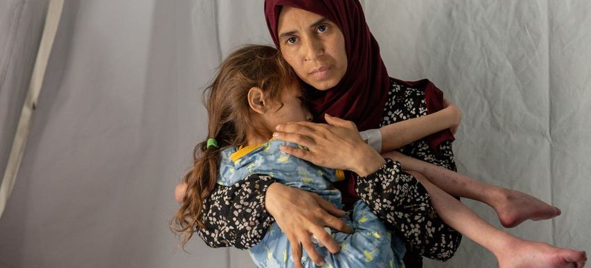 Un enfant de sept ans souffrant de malnutrition aiguë sévère et de déshydratation dans le sud de la bande de Gaza en avril.